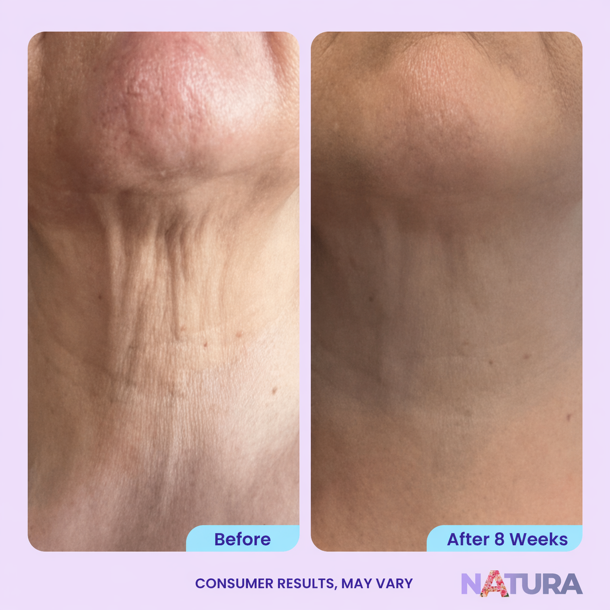 NATURA® Cuello Firme Reafirmante Antiedad